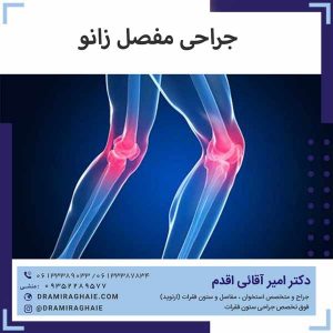 جراحی مفصل زانو