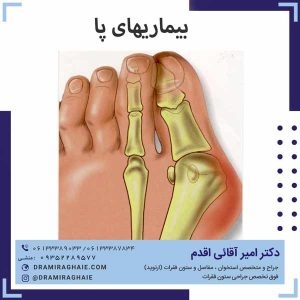بیماری های پا