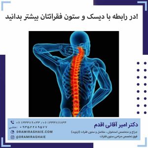 در رابطه با دیسک و ستون فقراتتان بیشتر بدانید!