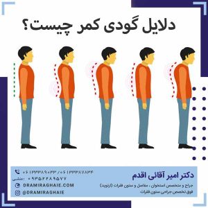 دلایل گودی کمر چیست؟