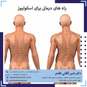 راه های درمانی برای اسکولیوز