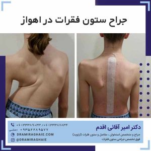 جراح ستون فقرات در اهواز