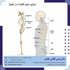 جراح ستون فقرات در اهواز