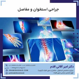 جراحی استخوان و مفاصل