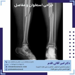 جراحی استخوان و مفاصل