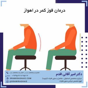 درمان قوز کمر در اهواز