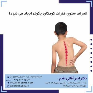 انحراف ستون فقرات کودکان چگونه ایجاد می شود؟