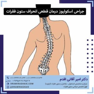 جراحی اسکولیوز درمان قطعی انحراف ستون فقرات