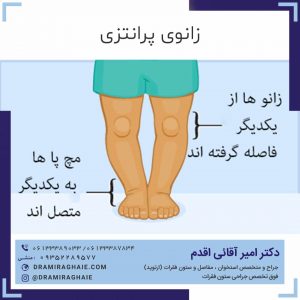 زانوی پرانتزی