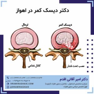 دکتر دیسک کمر در اهواز