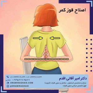 اصلاح قوز کمر