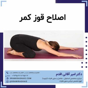 اصلاح قوز کمر
