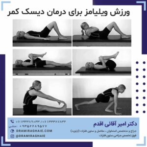 ورزش ویلیامز برای درمان دیسک کمر