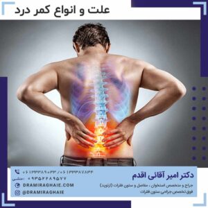 علت و انواع کمر درد