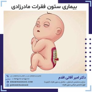 بیماری ستون فقرات مادرزادی